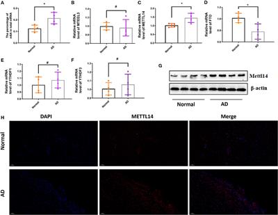 Transcriptome and N6-Methyladenosine RNA Methylome Analyses in Aortic Dissection and Normal Human Aorta